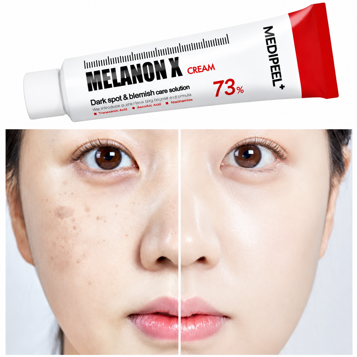Medi-Peel Melanon X Cream 73% 30ml